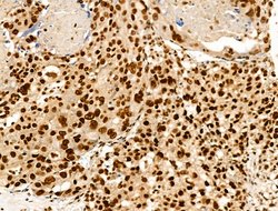 Invitrogen H2BK20ac Polyclonal Antibody 100 &mu;L; Unconjugated:Antibodies,