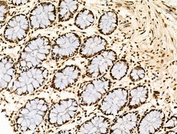 Invitrogen H2BK20ac Polyclonal Antibody 100 &mu;L; Unconjugated:Antibodies,