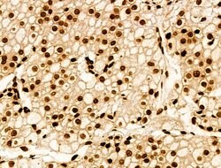 Invitrogen H2BK20ac Polyclonal Antibody 100 &mu;L; Unconjugated:Antibodies,