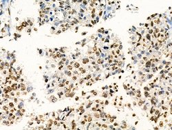 Invitrogen H2BK20ac Polyclonal Antibody 100 &mu;L; Unconjugated:Antibodies,