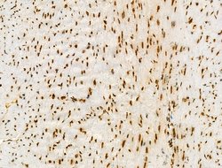 Invitrogen H2BK20ac Polyclonal Antibody 100 &mu;L; Unconjugated:Antibodies,