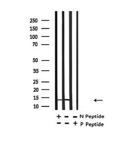 Invitrogen H2BK20ac Polyclonal Antibody 100 &mu;L; Unconjugated:Antibodies,