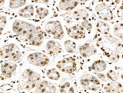 Invitrogen Histone H3ac (pan-acetyl) Polyclonal Antibody 100 &mu;L; Unconjugated:Antibodies,