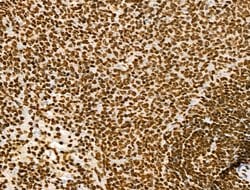 Invitrogen Histone H3ac (pan-acetyl) Polyclonal Antibody 100 &mu;L; Unconjugated:Antibodies,