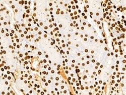 Invitrogen Histone H3ac (pan-acetyl) Polyclonal Antibody 100 &mu;L; Unconjugated:Antibodies,