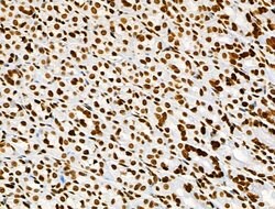 Invitrogen Histone H3ac (pan-acetyl) Polyclonal Antibody 100 &mu;L; Unconjugated:Antibodies,