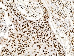Invitrogen Histone H3ac (pan-acetyl) Polyclonal Antibody 100 &mu;L; Unconjugated:Antibodies,