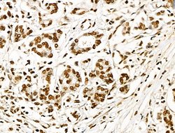 Invitrogen Histone H3ac (pan-acetyl) Polyclonal Antibody 100 &mu;L; Unconjugated:Antibodies,