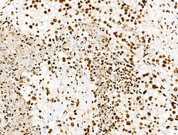 Invitrogen Histone H3ac (pan-acetyl) Polyclonal Antibody 100 &mu;L; Unconjugated:Antibodies,