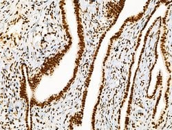 Invitrogen Histone H3ac (pan-acetyl) Polyclonal Antibody 100 &mu;L; Unconjugated:Antibodies,
