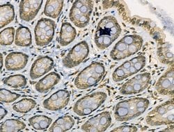 Invitrogen Acetyl-NFkB p65 (Lys314, Lys315) Polyclonal Antibody 100 &mu;L;