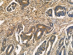 Invitrogen Acetyl-SOD2 (Lys68) Polyclonal Antibody 100 &mu;L; Unconjugated:Antibodies,