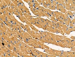 Invitrogen Acetyl-SOD2 (Lys68) Polyclonal Antibody 100 &mu;L; Unconjugated:Antibodies,