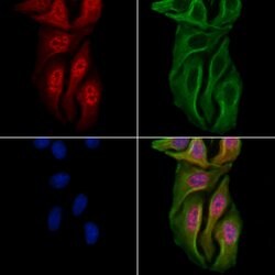 Invitrogen AEBP1 Polyclonal Antibody 100 &mu;L; Unconjugated:Antibodies,