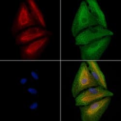 Invitrogen CANT1 Polyclonal Antibody 100 &mu;L | Buy Online | Invitrogen&trade; | Fisher Scientific