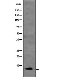 Invitrogen MIP-3 alpha Polyclonal Antibody 100 &mu;L | Buy Online | Invitrogen&trade; | Fisher Scientific