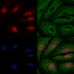 Invitrogen CCNK Polyclonal Antibody 100 μL; Unconjugated:Antibodies,