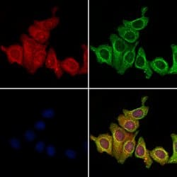 Invitrogen CD2AP Polyclonal Antibody 100 &mu;L; Unconjugated:Antibodies,