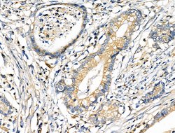 Invitrogen CD2AP Polyclonal Antibody 100 &mu;L; Unconjugated:Antibodies,