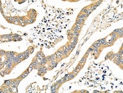 Invitrogen CD2AP Polyclonal Antibody 100 &mu;L; Unconjugated:Antibodies,