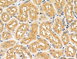 Invitrogen CD2AP Polyclonal Antibody 100 &mu;L; Unconjugated:Antibodies,