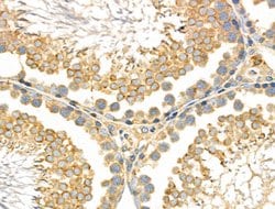 Invitrogen CD2AP Polyclonal Antibody 100 &mu;L; Unconjugated:Antibodies,