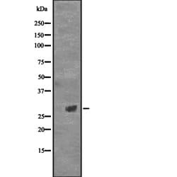 Invitrogen CD154 (CD40 Ligand) Polyclonal Antibody 100 &mu;L; Unconjugated:Antibodies