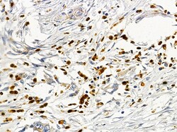 Invitrogen CD48 Polyclonal Antibody 100 μL; Unconjugated:Antibodies,