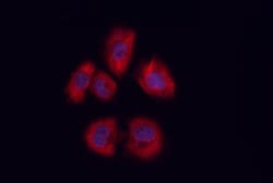 Invitrogen CD81 Polyclonal Antibody 100 &mu;L; Unconjugated:Antibodies,