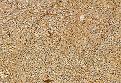 Invitrogen CD81 Polyclonal Antibody 100 &mu;L; Unconjugated:Antibodies,