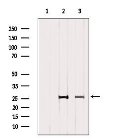Invitrogen CD81 Polyclonal Antibody 100 &mu;L; Unconjugated:Antibodies,