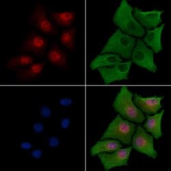 Invitrogen CITED2 Polyclonal Antibody 100 &mu;L; Unconjugated:Antibodies,