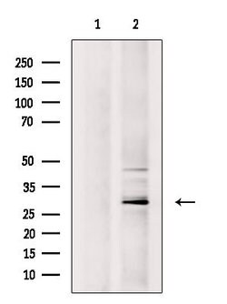 Invitrogen CITED2 Polyclonal Antibody 100 &mu;L; Unconjugated:Antibodies,