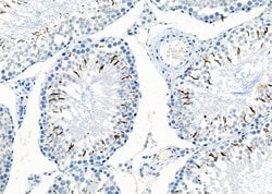 Invitrogen CITED4 Polyclonal Antibody 100 &mu;L; Unconjugated:Antibodies,