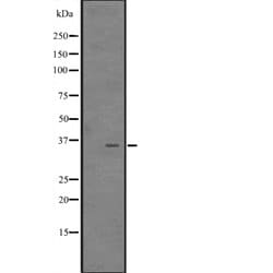 Invitrogen CITED4 Polyclonal Antibody 100 &mu;L; Unconjugated:Antibodies,