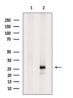 Invitrogen DIRAS3 Polyclonal Antibody 100 &mu;L; Unconjugated:Antibodies,