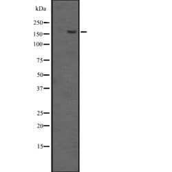 Invitrogen EHMT1 Polyclonal Antibody 100 &mu;L; Unconjugated:Antikroppar