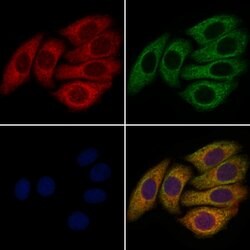 Invitrogen FGF8 Polyclonal Antibody 100 &mu;L; Unconjugated:Antibodies,
