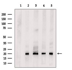 Invitrogen FGF8 Polyclonal Antibody 100 &mu;L; Unconjugated:Antibodies,