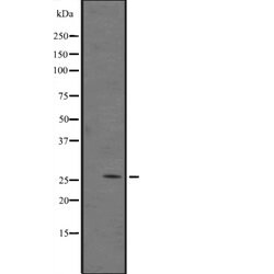 Invitrogen GADD45A Polyclonal Antibody 100 &mu;L; Unconjugated:Antibodies,