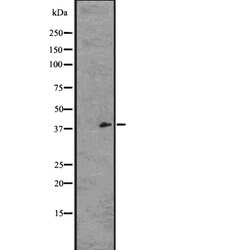 Invitrogen GPR21 Polyclonal Antibody 100 &mu;L; Unconjugated:Antibodies,