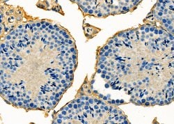 GPR64 Polyclonal Antibody:Antibodies, Polyclonal