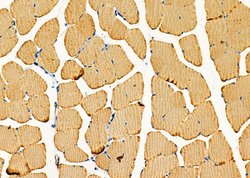 GPR64 Polyclonal Antibody:Antibodies, Polyclonal