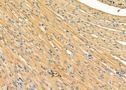 GPR64 Polyclonal Antibody:Antibodies, Polyclonal