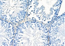 GPR64 Polyclonal Antibody:Antibodies, Polyclonal