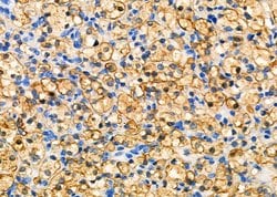 Invitrogen GPR81 Polyclonal Antibody 100 &mu;L; Unconjugated:Antibodies,