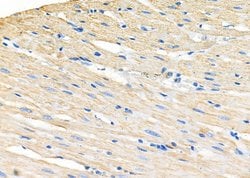 Invitrogen GPR81 Polyclonal Antibody 100 &mu;L; Unconjugated:Antibodies,