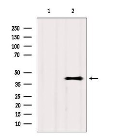Invitrogen GPR81 Polyclonal Antibody 100 &mu;L; Unconjugated:Antibodies,