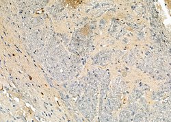 GRIP1 Polyclonal Antibody:Antibodies, Polyclonal