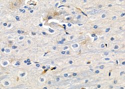 GRIP1 Polyclonal Antibody:Antibodies, Polyclonal